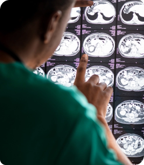 Traumatic Brain Injury (TBI)